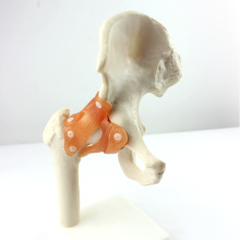 JOINT06 (12353) Medical Anatomy Natural Size Hip Joint Models